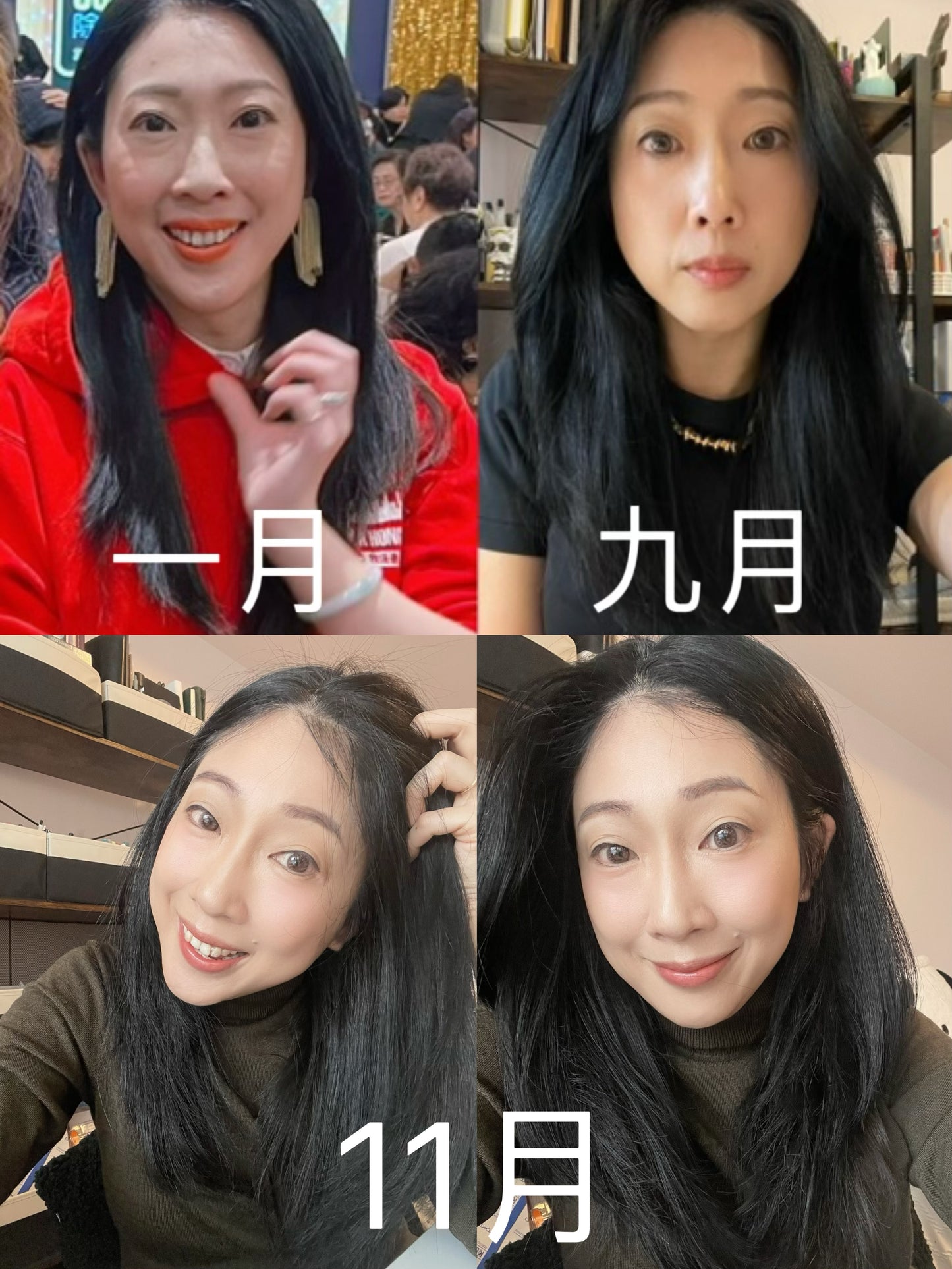 (10月16日發貨)加拿大亞省 Apothic 防脫髮及增髮頭皮精華液