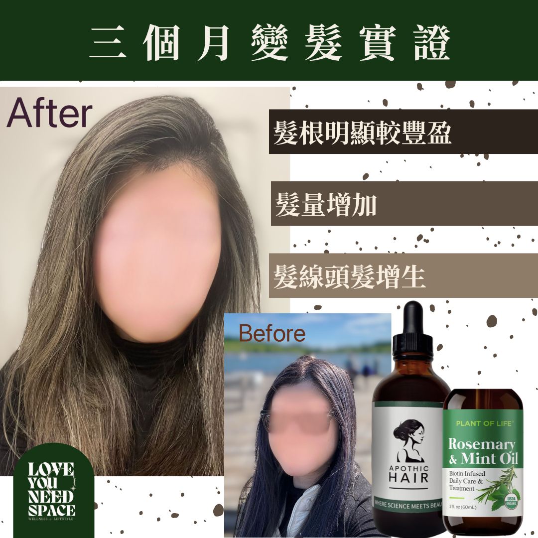 加拿大亞省 Apothic 防脫髮及增髮頭皮精華液