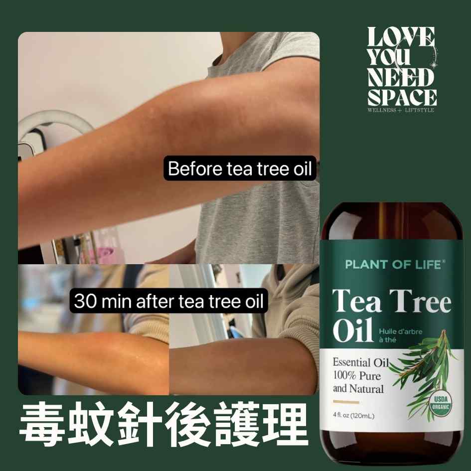 Tea Tree Oil （茶樹油）香氛、護膚及護髮功效